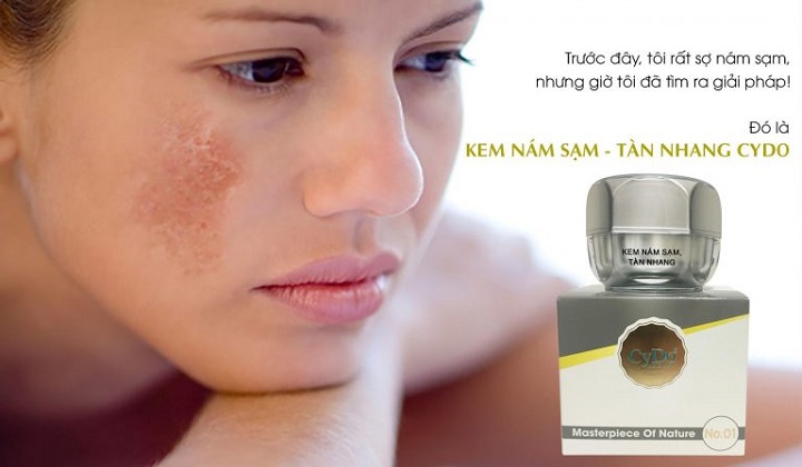 kem cydo trị nám tan nhang lâu năm hiệu quả an toàn