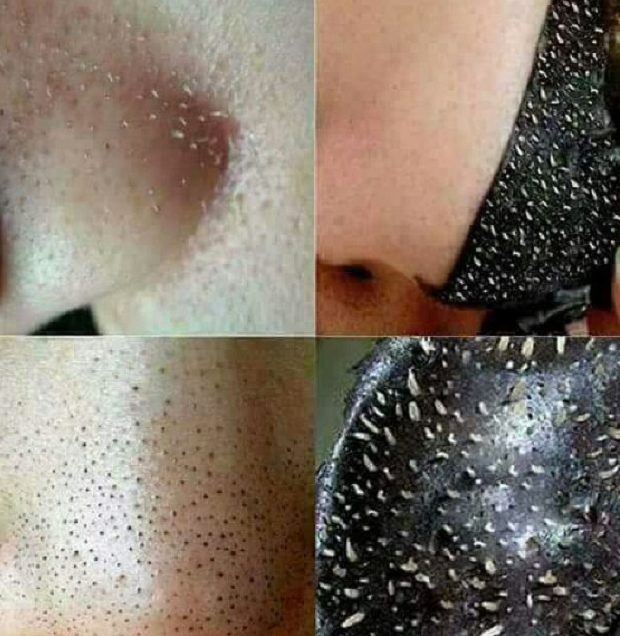 gel-lot-mun-cam-mun-dau-den