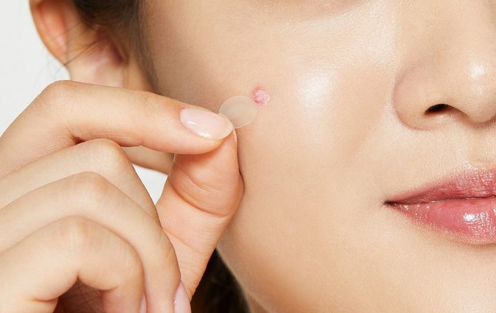 mieng-dan-tri-mun-some-by-mi