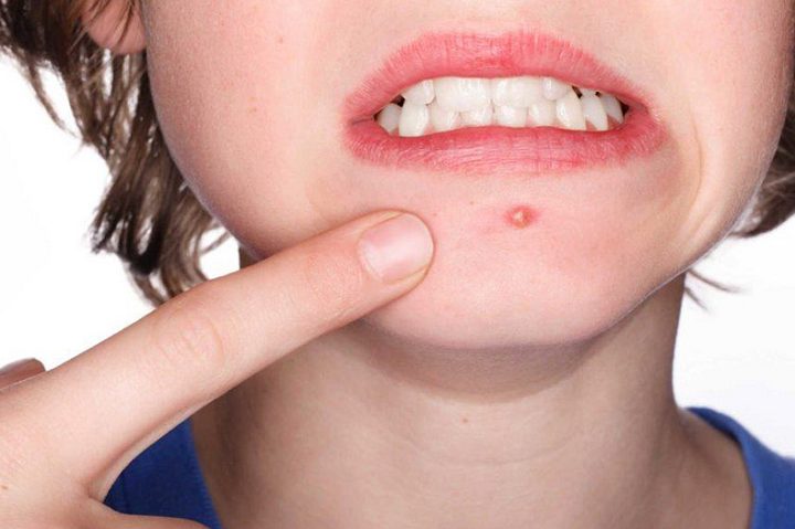 mun-boc-mun-viem-mun-mu